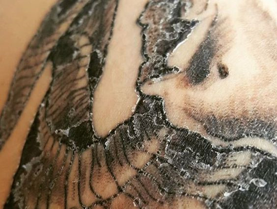 How To Take Care Of A Peeling Tattoo Coming Off